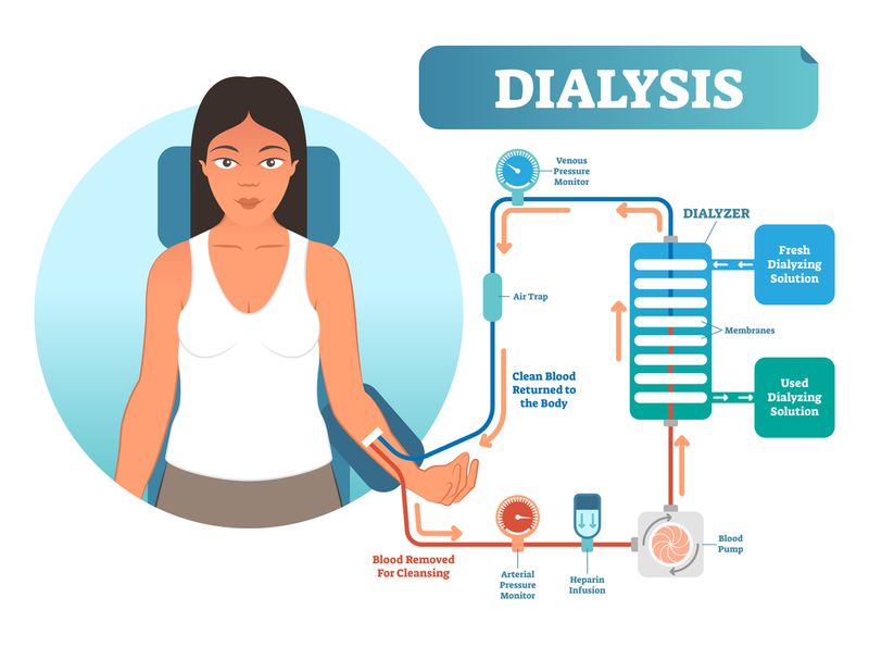 dialysis-access-center-pacific-cardiovascular-vein-institute